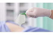 Conformabilità di Exufiber sulla mano